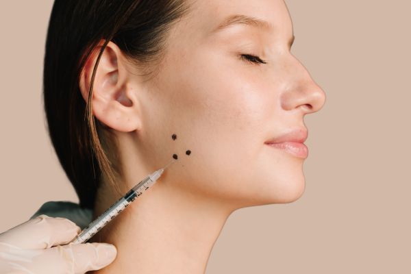 Botox® Bruxismus, Magazin, California Skin, Ihre Experten für Faltenbehandlungen